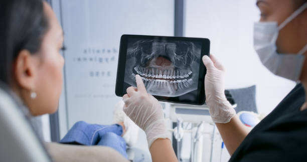 Licensed Tooth Extraction service in Woodlands, CA - Smile Center Dentistry